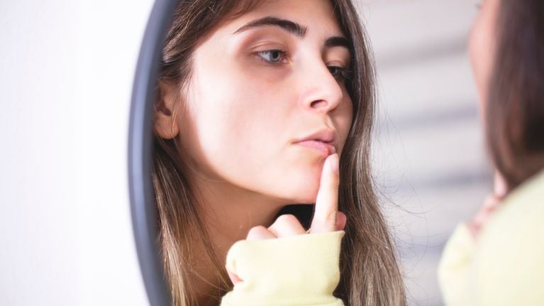 Woman applying cold sore cream on lips in front of mirror