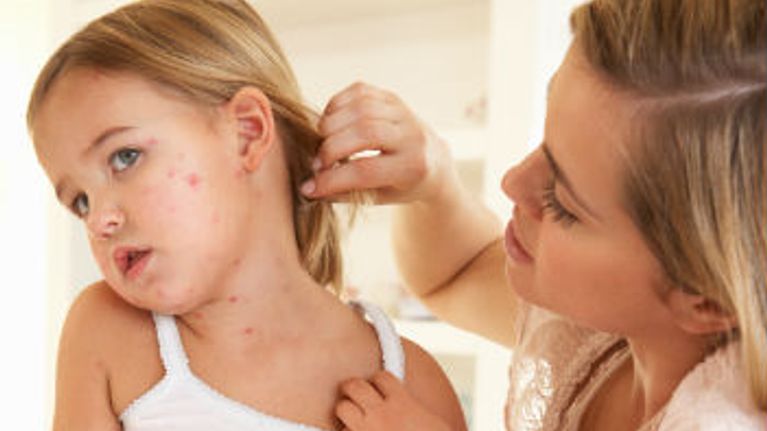 10 Common Rashes on Kids (with photos): Symptoms and Treatment