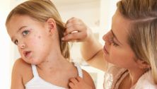 10 Common Rashes on Kids (with photos): Symptoms and Treatment